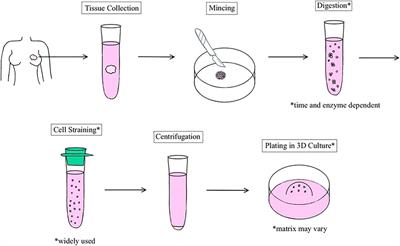 Current Status of Breast Organoid Models